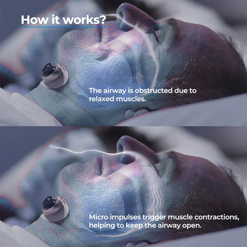 Chin Clip Anti-Snoring Adjustable Soft Fit