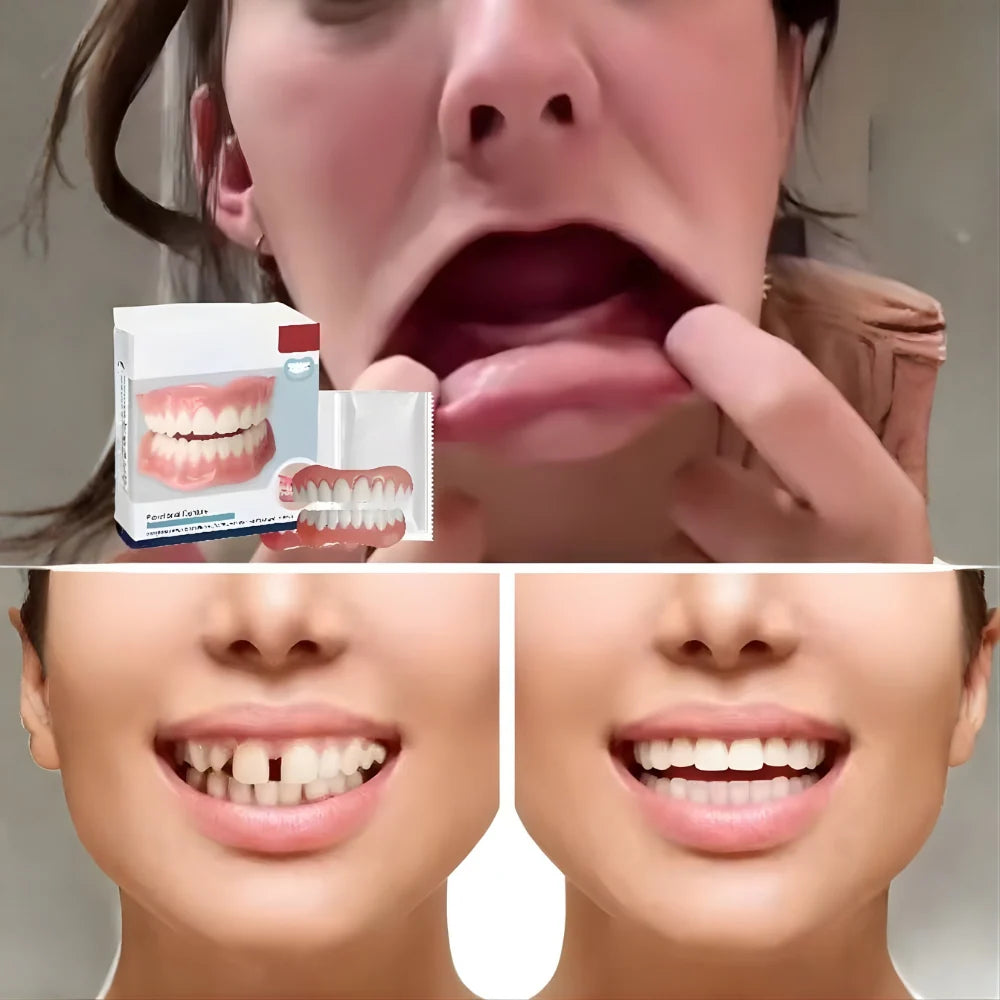 Cosmetic Denture Set Moldable Resin Upper & Lower