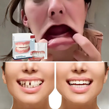 Cosmetic Denture Set Moldable Resin Upper & Lower
