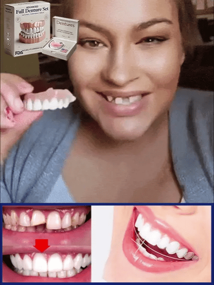Denture Kit Moldable Boil-And-Bite Upper & Lower Set