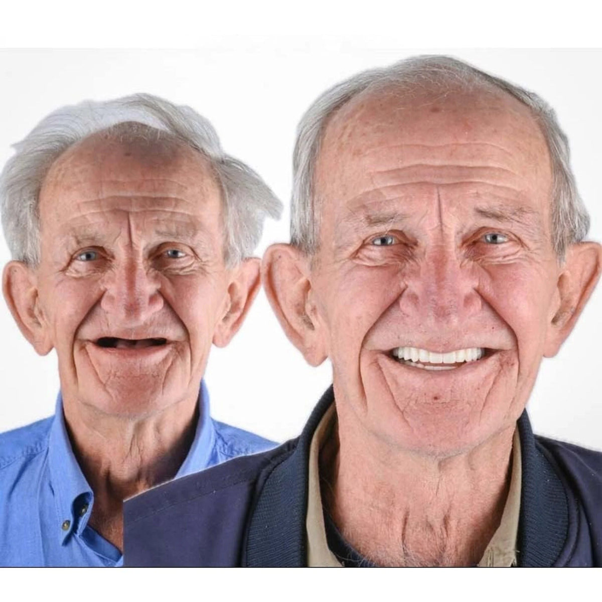 Denture Set Upper & Lower Flexible Cushion Grip