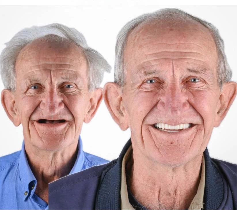Dentures Upper & Lower Adaptive Gel Fit Set