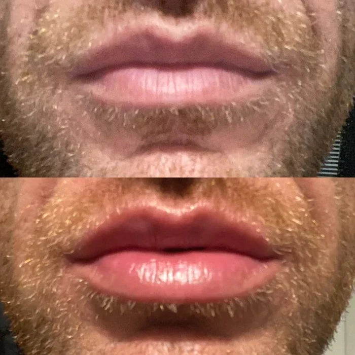 Lip Plumper Serum Cooling Hydrating 48-Hour Effect