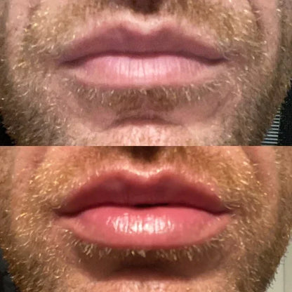 Lip Plumper Serum Cooling Hydrating 48-Hour Effect