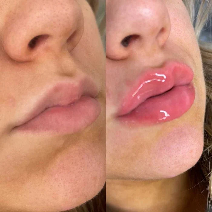 Lip Plumper Serum Cooling Hydrating 48-Hour Effect