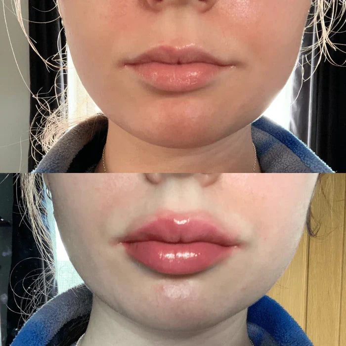 Lip Plumper Serum Instant Plumping Cooling Hydration