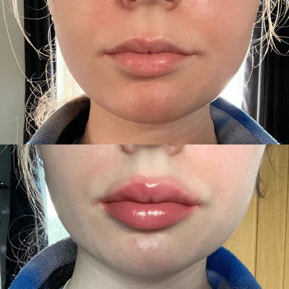 Lip Plumper Serum Instant Plumping Cooling Hydration