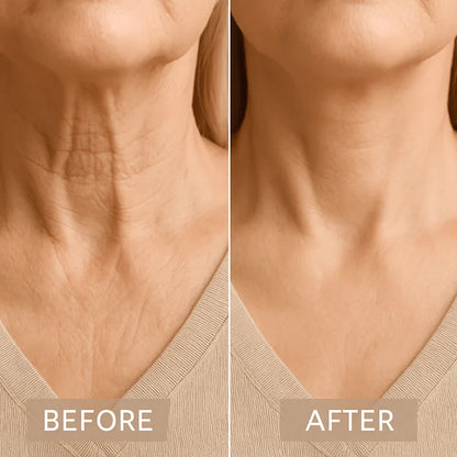 Neck Lifting Tape Invisible Sweat-Resistant Hypoallergenic Up to 10-Hour Hold