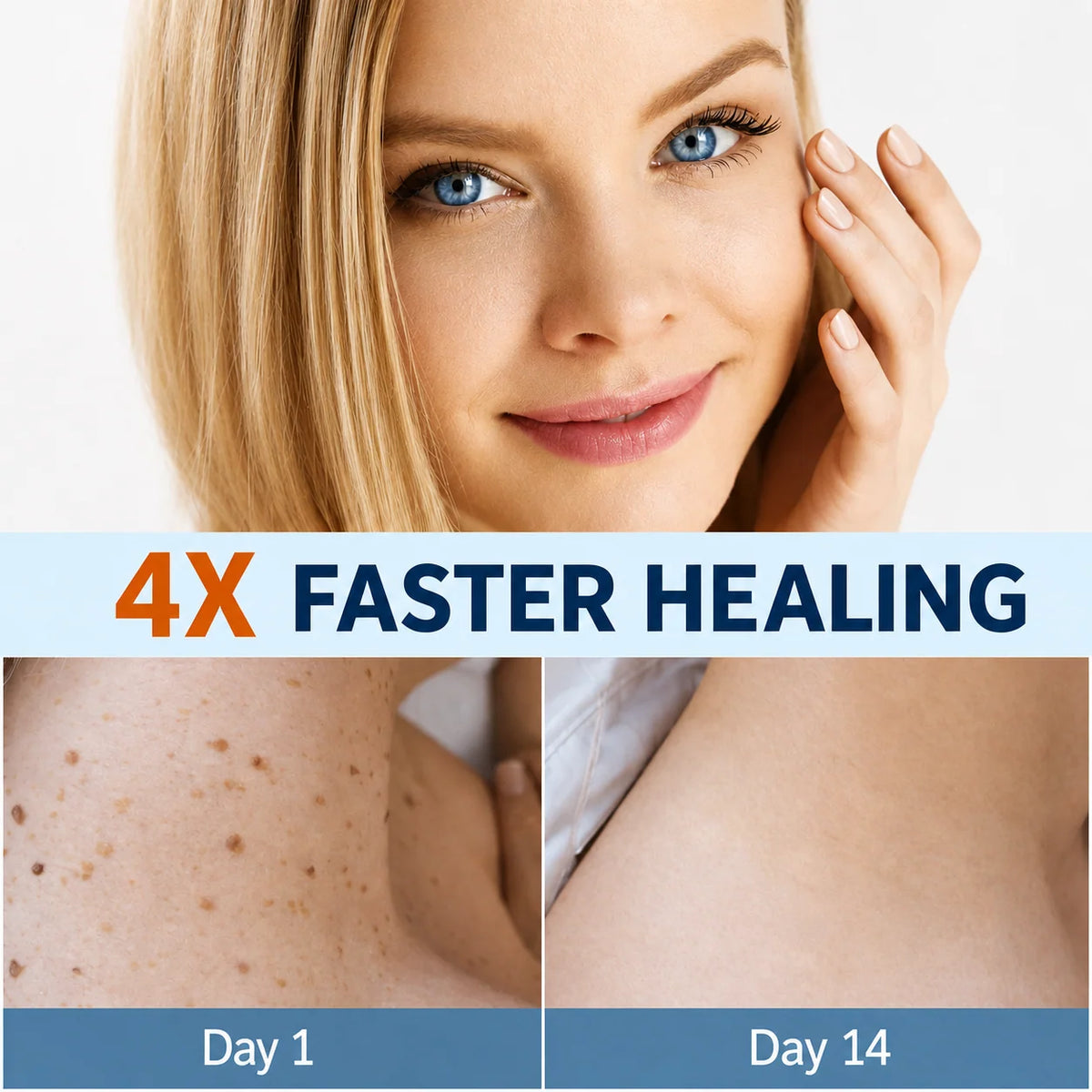 Skin Tag Remover Patches Gentle Non-Invasive Application